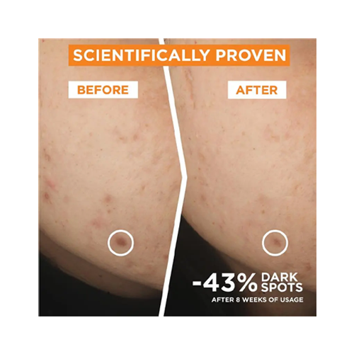 Garnier Skin Active Vitamin C Brightening Serum 30ml