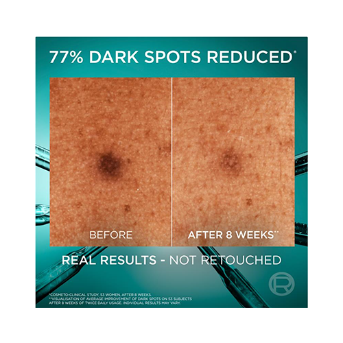 L'Oreal Bright Reveal Niacinamide Dark Spot Serum 30ml