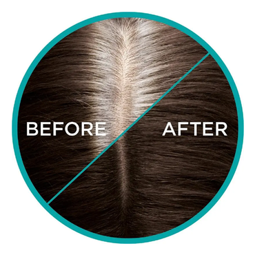 L'Oreal Paris Magic Retouch Temporary Root Concealer Spray Dark Brown