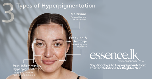 Say Goodbye to Hyperpigmentation: Trusted Solutions for Brighter Skin