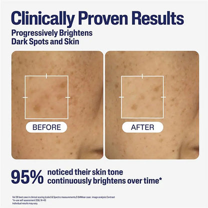 Cetaphil Bright Healthy Radiance Perfecting Serum 30ml