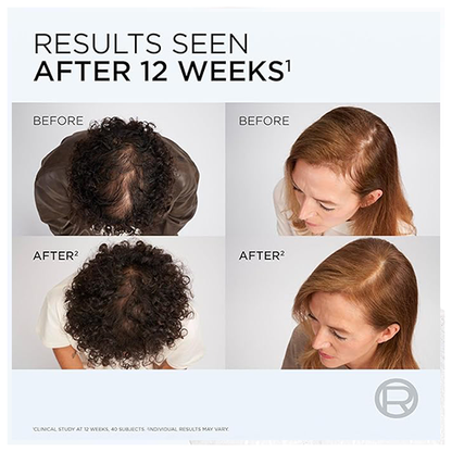 L'Oreal Elvive Growth Booster Anti Fall Shampoo 200ml