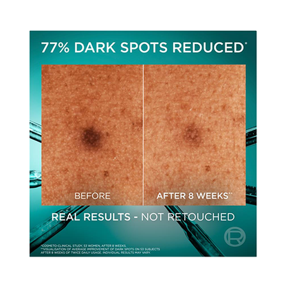 L'Oreal Bright Reveal Niacinamide Dark Spot Serum 30ml