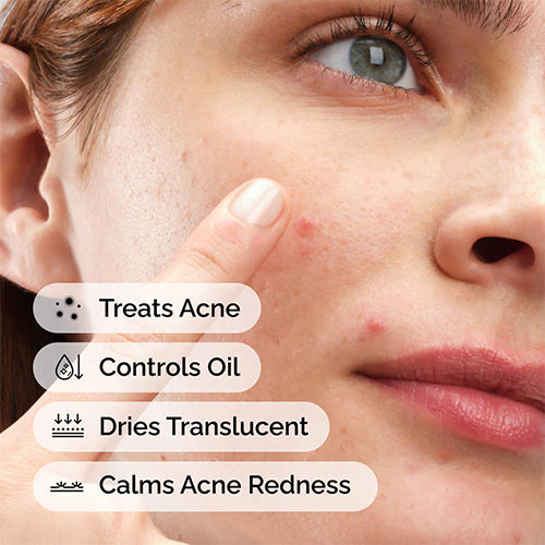 The Ordinary Sulfur 10% Powder to Cream Concentrate 5g