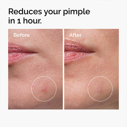 The Ordinary Sulfur 10% Powder to Cream Concentrate 5g